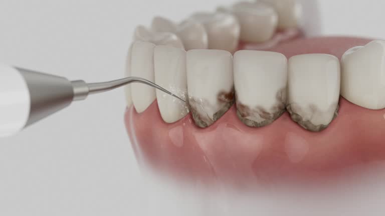 Trusted Emergency Dentist service in Lusby, MD - Dentist Open Now